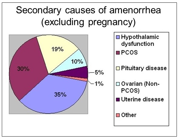 Amenorrhea: Causes, Symptoms, Diagnosis And Treament